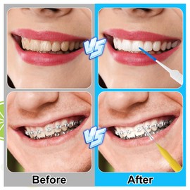 lanjue 355 Pieces Braces Flossers for Braces, Interdental Brush Soft Dental Floss Picks Braces Cleaning Kit Toothpick Dental Brush Braces Teeth Flossers Brushes for Tooth Cleaner(Multiple Sizes)
