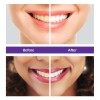 Rabbitooth BestBy10/25 Rabbitooth Purple Teeth Whitening Serum 30ml Non-invasive Zero