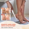 findqiao Glass foot file and callus remover, highly effective hard