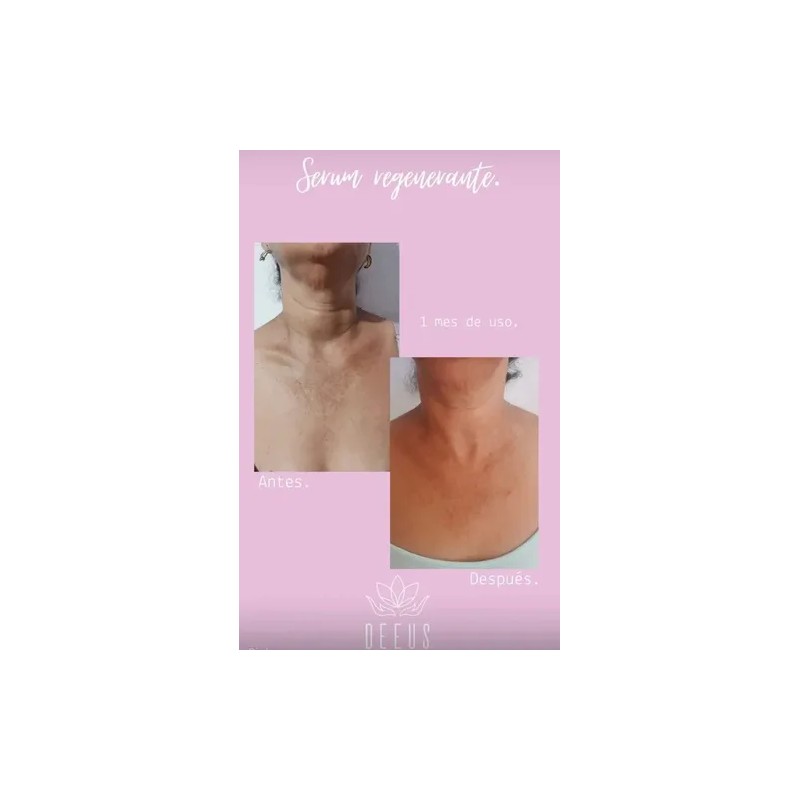 Tónico/serum Facial Regenerante 50ml Artesanal 100% Orgánico