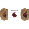 Doc's ProPlugs (Pair) Clear - Sm/Med