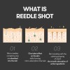 Reedle Sérum Microagujas Ácido Hialurónico 50ml Adultos