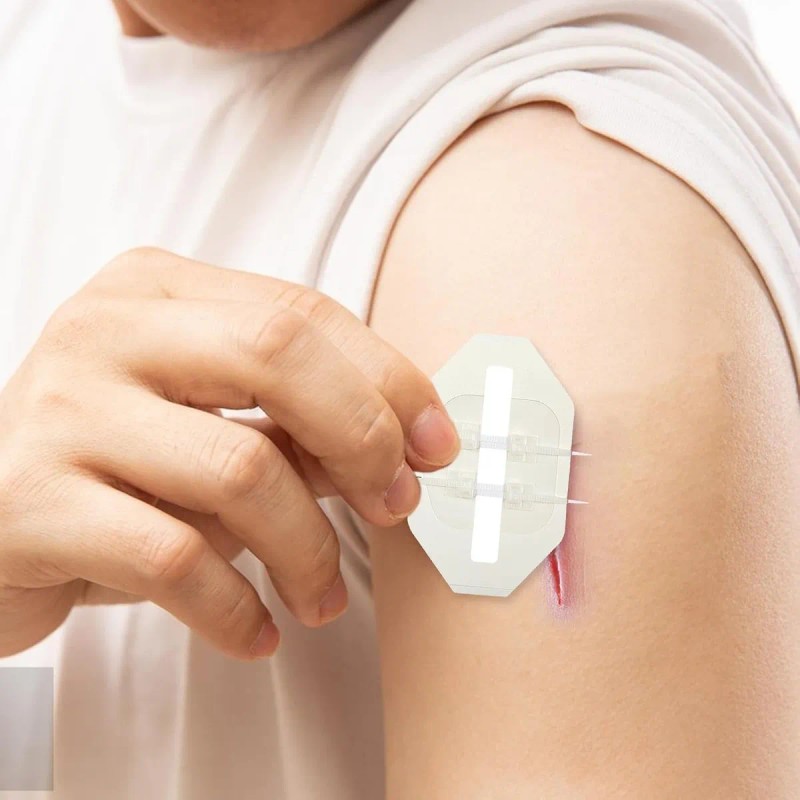 Tiras de Cierre para Heridas Emergencia 4PZ Sutura Sin Agujas