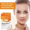 YFLCFCX Nose Pose Patches, 5 * 2 Counts (Pack of