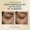 Crema De Noche Antiedad Con Retinol Para Arrugas Profundas