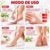 2PCS Cremas de Urea al 30% para Pies, Crema para