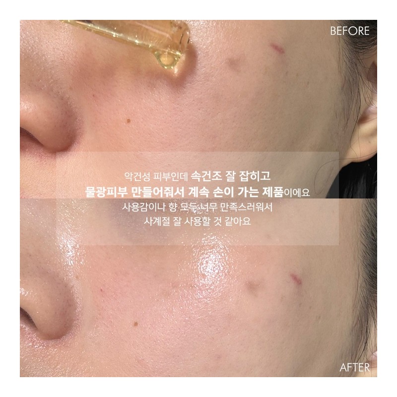 Leadermiss Re-Sink Quick-drying hyaluronic acid ampoule for extremely dry skin