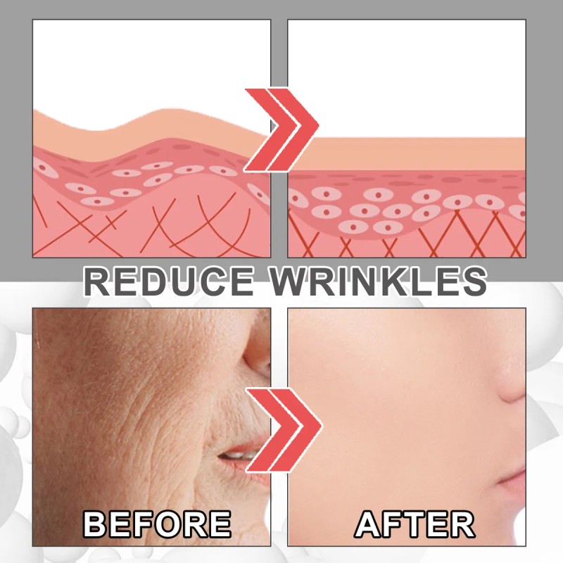 **crema Facial Hidratante De Colágeno For La Piel