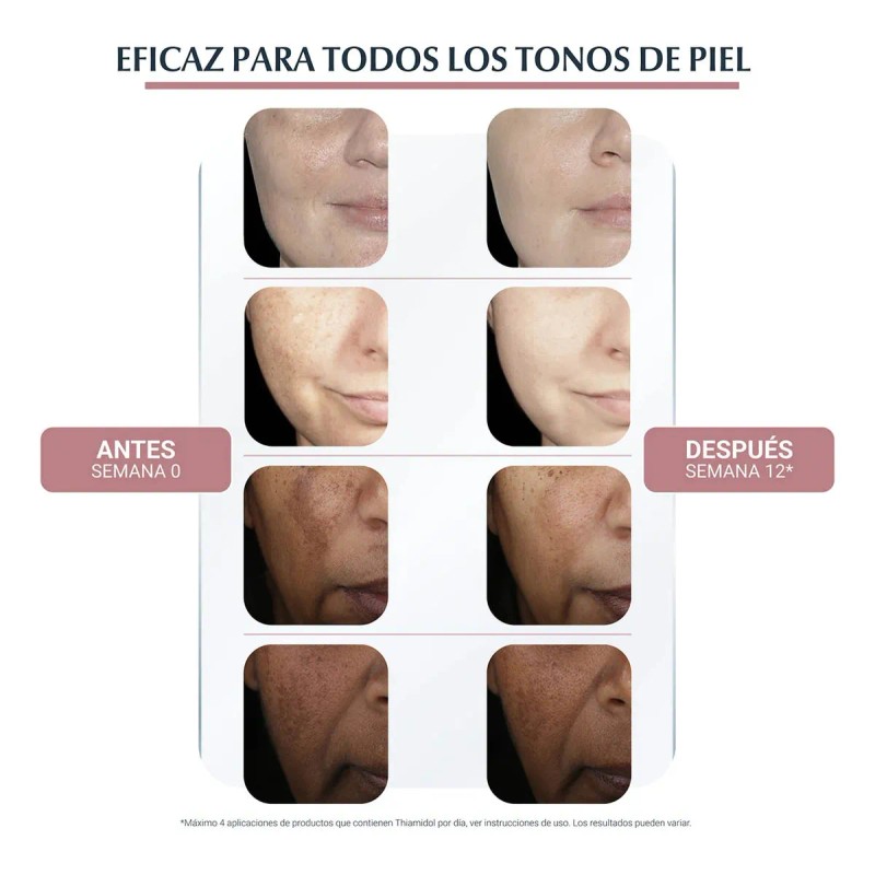 Eucerin Anti-pigment Serum Facial Anti-hiperpigmentación Todo Tipo De Piel Día/noche