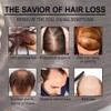 Aceite Natural de Romero para Crecimiento del Cabello