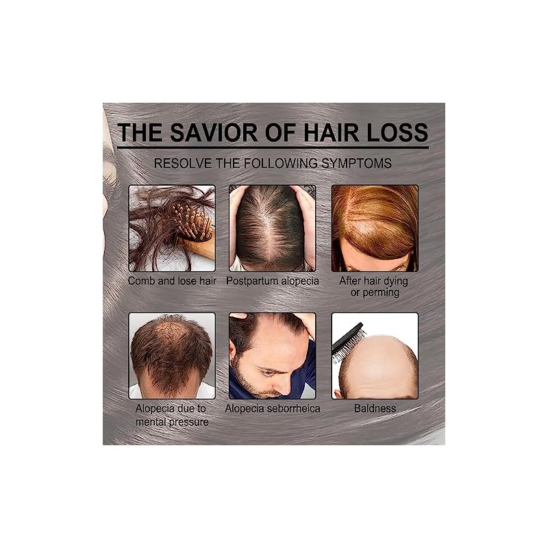 Aceite Natural de Romero para Crecimiento del Cabello