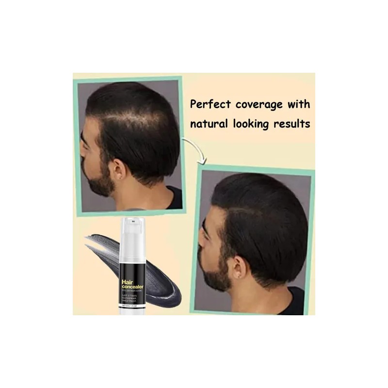 Corrector De Cabello Hairfillup Para Hombre, Hairfillup Hair