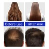 Aceite Para El Crecimiento Del Cabello Batana 60 Ml* 2