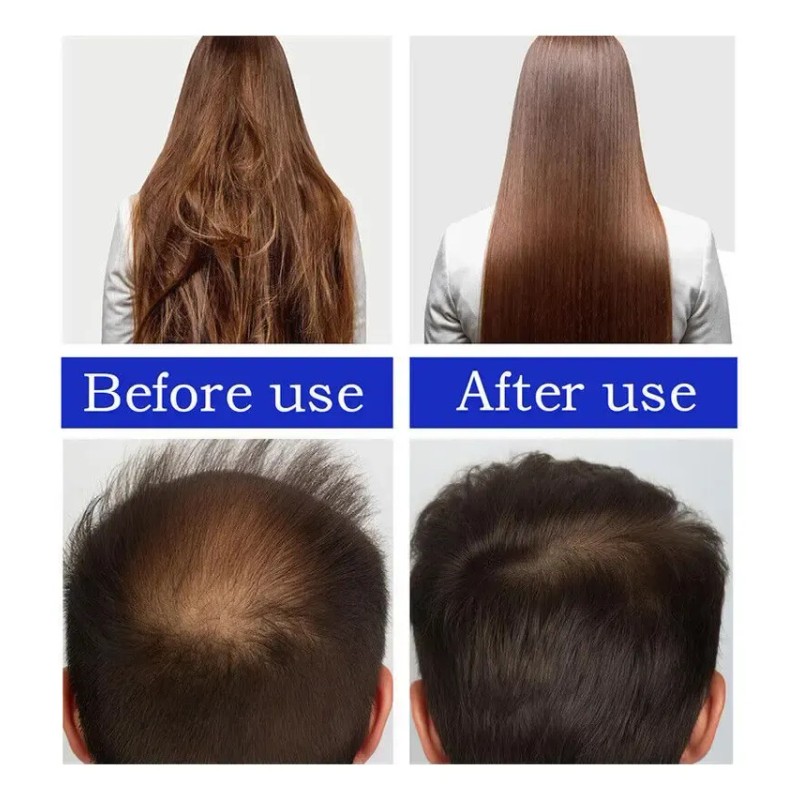 Aceite Para El Crecimiento Del Cabello Batana 60 Ml* 2