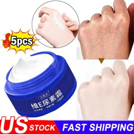 Unbranded 5PCS Spot Fading Urea Cream,Vitamin E Urea Cream,2.47Fl.o - 1PCS-Urea Cream