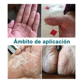 Artken Reparación Para Pies Agrietados Y Resecos - Crema T