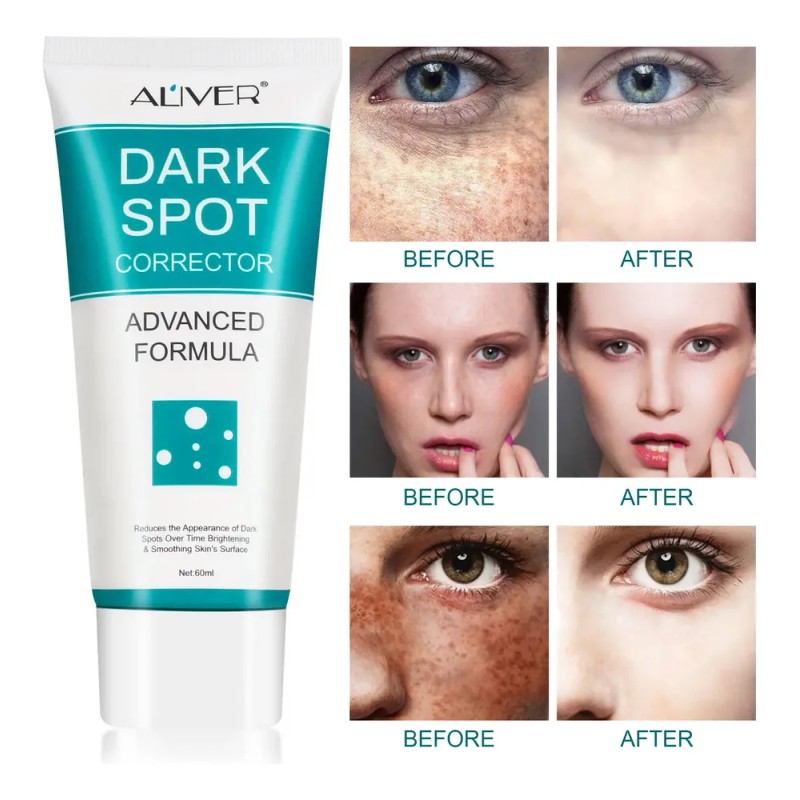 Crema Correctora Facial Manchas Acné Paño Puntos Negros