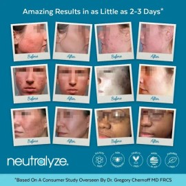 Tratamiento Para Acné Avanzado Neutralyze 2.0 90 Dias Import                                                                                          