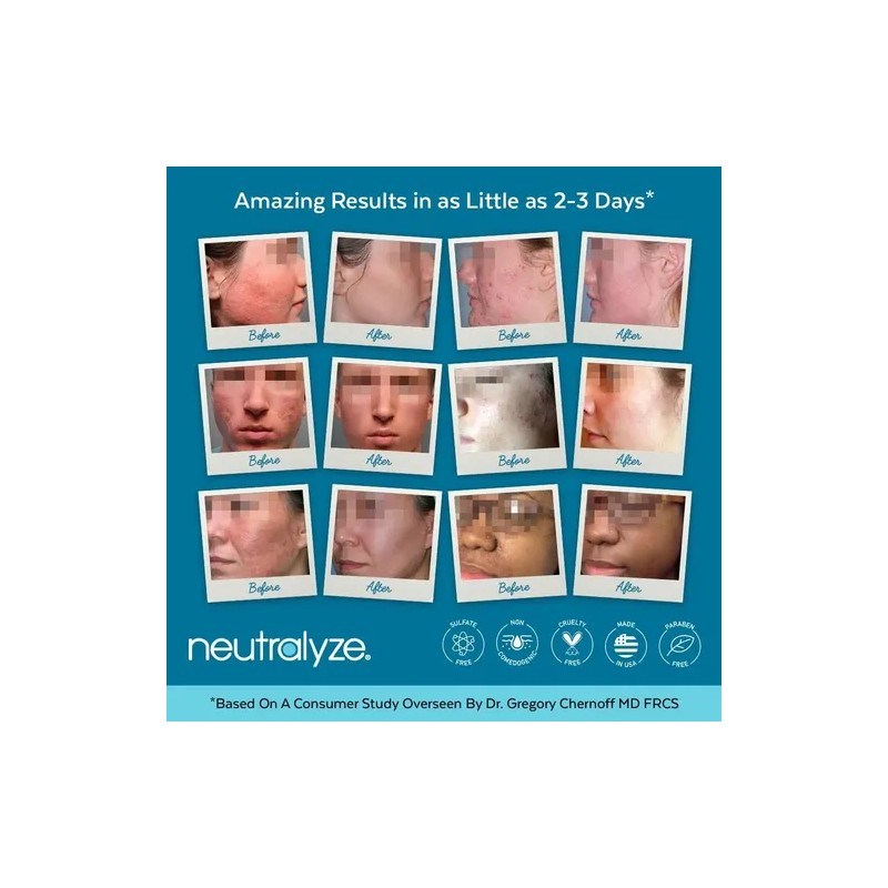 Tratamiento Para Acné Avanzado Neutralyze 2.0 90 Dias Import