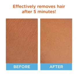 Sally Hansen Hair Remover for Face | Cream Depilatory + Aftercare Lotion | Sweet Almond & Shea Butter Infused