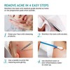 LUPO Comedones/Blackhead Remover Set – Stainless Steel Double Tool Kit – (Pack of 7)
