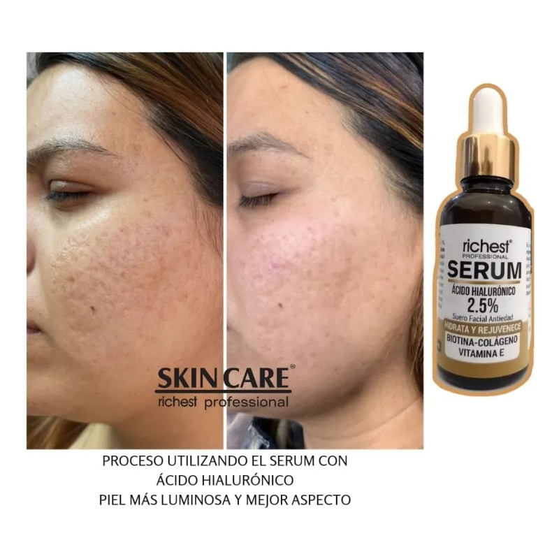 Serum Ácido Hialurónico 2.5% Biotina-colágeno-vitamina E Todo Tipo De Piel