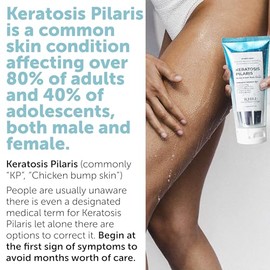Rida Hair Research Institute- Exfoliante corporal KP Bump Eraser, tratamiento para la queratosis pilaris, tratamiento de piernas de fresa para mujeres, Bump Er