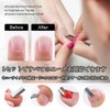 Forahome Cuticle Pusher Cuticle Pusher, Cuticle Processing Set, 4 Types,