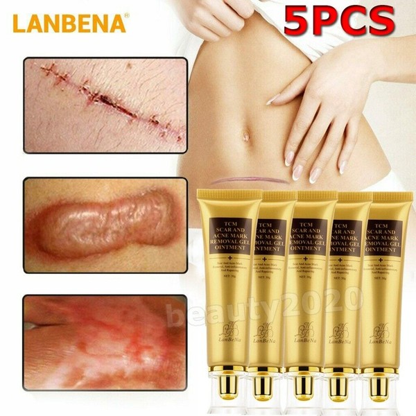 LanBeNa Ginseng Acne Treatment Scar Removal Cream Gel Stretch Cut Burn Spot Mark