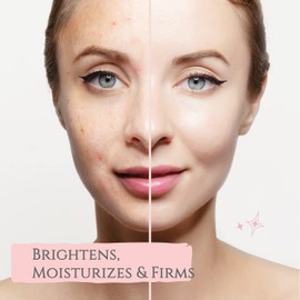 A TYPICAL Jelly Mask for Facials Professional, Hydrojelly Mask for Facials, 5 Pack Kiwi, Rose, Aloe, Lavender & Gold Powder Peel Off, Esthetician Spa-Quality Face Skincare Mask.