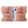Crema Anti Acné Elimina Granos Espinillas Tratamiento 30g