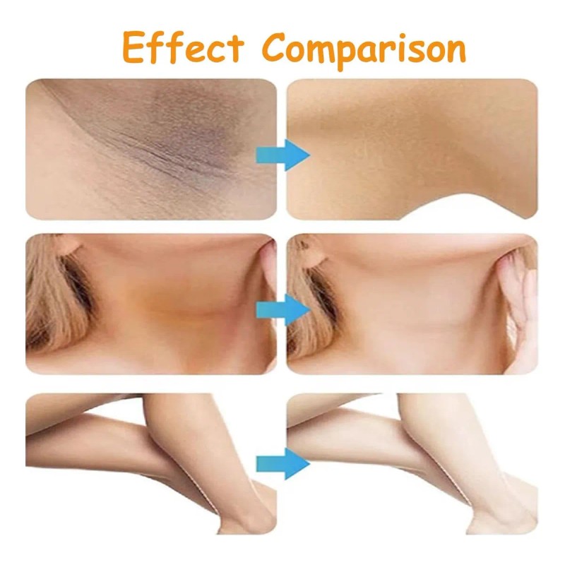 Crema Para Manchas Oscuras, Corrector De Manchas Solares Y P