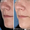 Zo Skin Health Instant Pore Refiner, Sérum para Minimizar Poros,