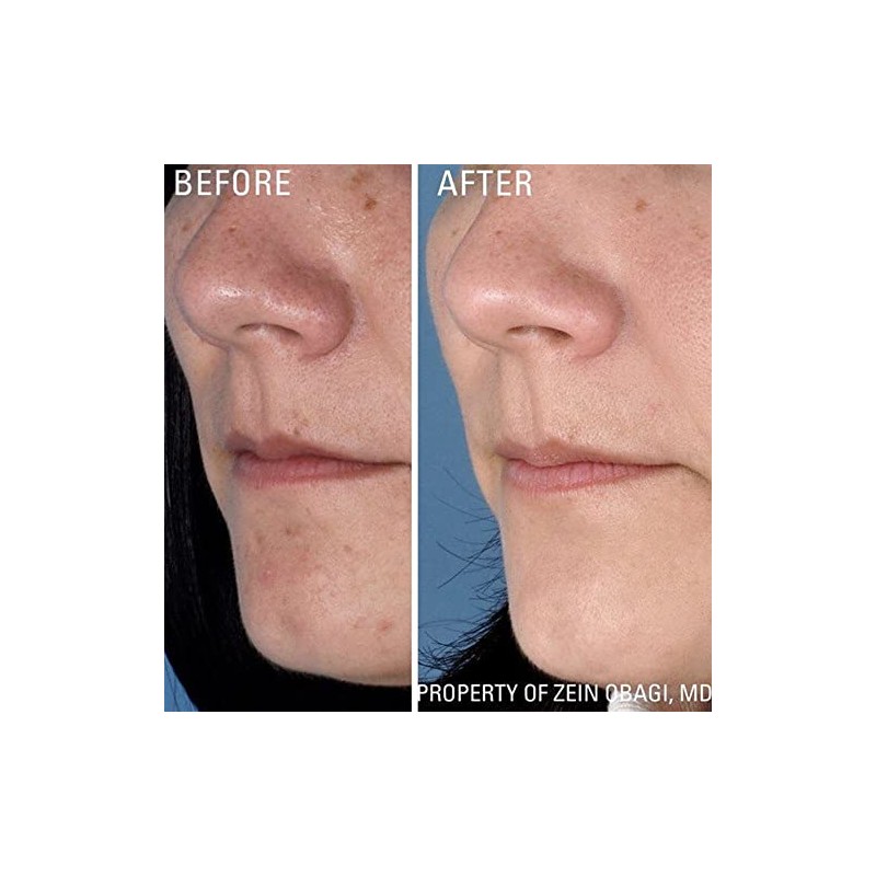 Zo Skin Health Instant Pore Refiner, Sérum para Minimizar Poros,