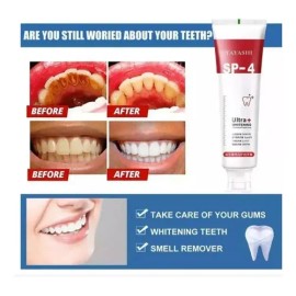 Pasta De Dientes Sp-4 Con Probióticos Blanqueadores                                                                                                   