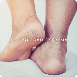 Derman DB Calm Emulsión Corporal │ Urea-D 10% + Ácido Hialurónico │ 400 mL