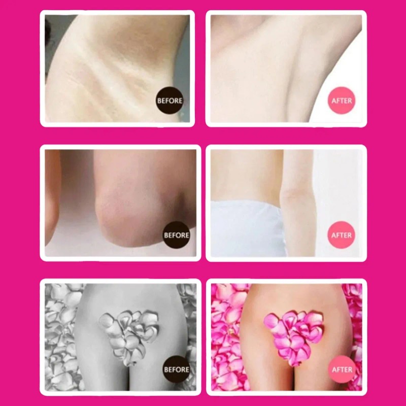Crema Aclaradora Leche Yogurt Axilas Cuello Zona Intima