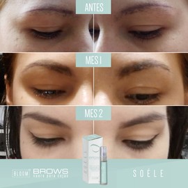 SOÉLE Bloom Brows | Suero para Cejas | 10 Activos