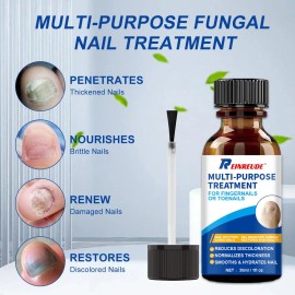 Tratamiento Extrafuerte para Hongos en las Uñas de los Pies