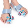 Tech Love Hallux Valgus Correction Fixing Plate Upgrade Double Tension