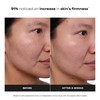Paula's Choice CLINICAL 1% Retinol Face Treatment with Peptides, Vitamin