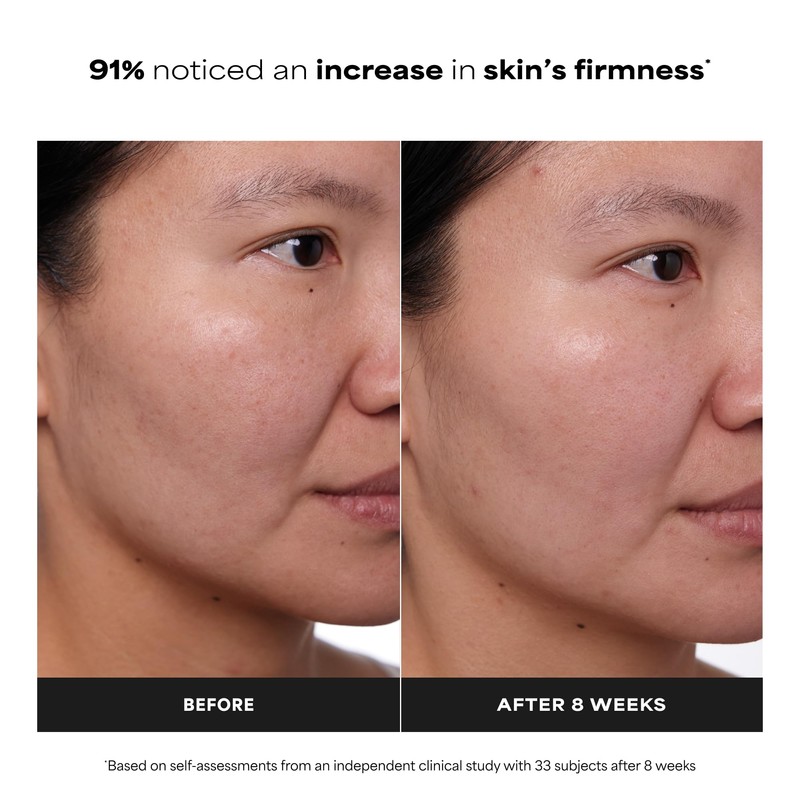 Paula's Choice CLINICAL 1% Retinol Face Treatment with Peptides, Vitamin