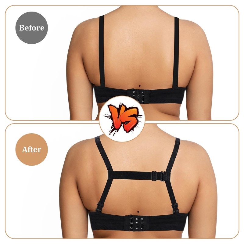Tyqour 6 Pcs Bra Strap Holders for Slipping Women's Non-Slip