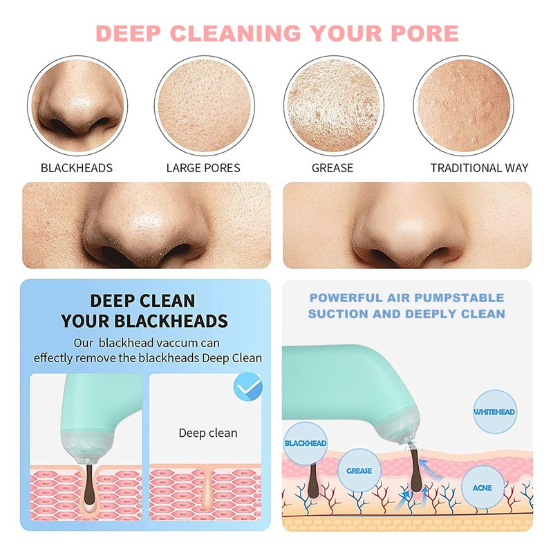 Vacuum Blackhead Remover Handheld Mini Lifting Massage Deep Clean USB
