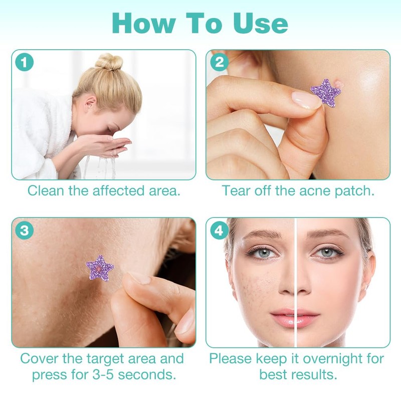 BUTBU Pack of 400 Star-Shaped Pimple Patch, Hydrocolloid Pimple Patch