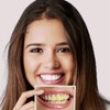 RIBHNXHI Teeth Whitening Strips - 28 Strips (14 Sets) Enamel
