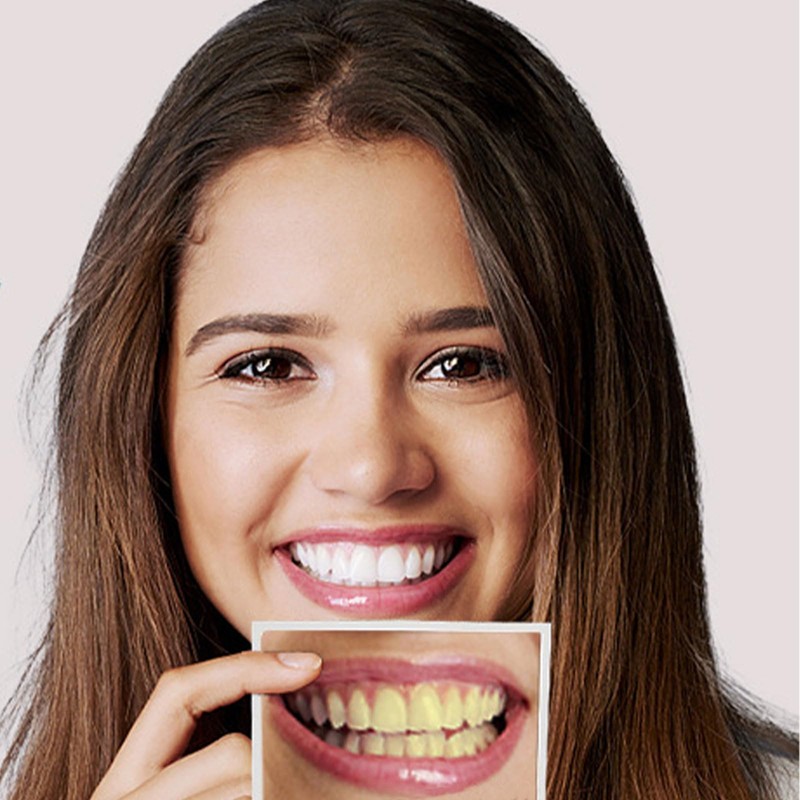 RIBHNXHI Teeth Whitening Strips - 28 Strips (14 Sets) Enamel