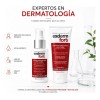 Kit Exderm Fort Shampoo + Loción Anticaída Cabello Revitalizado
