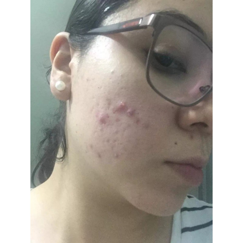 Organimar Máscarilla Exfoliante Facial Detox Activador 50gr