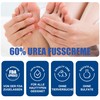 60% Urea Cream Foot Cream for Cracked Heels and Dry